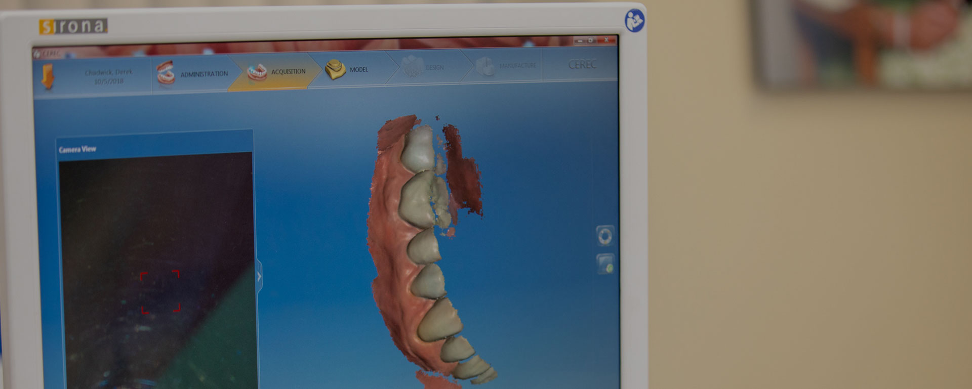 Digital dental x-ray