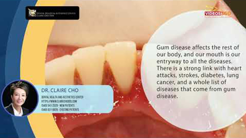 Good Gum Health = Good Whole-Body Health - Roselle Park Dental & Implants  Blog