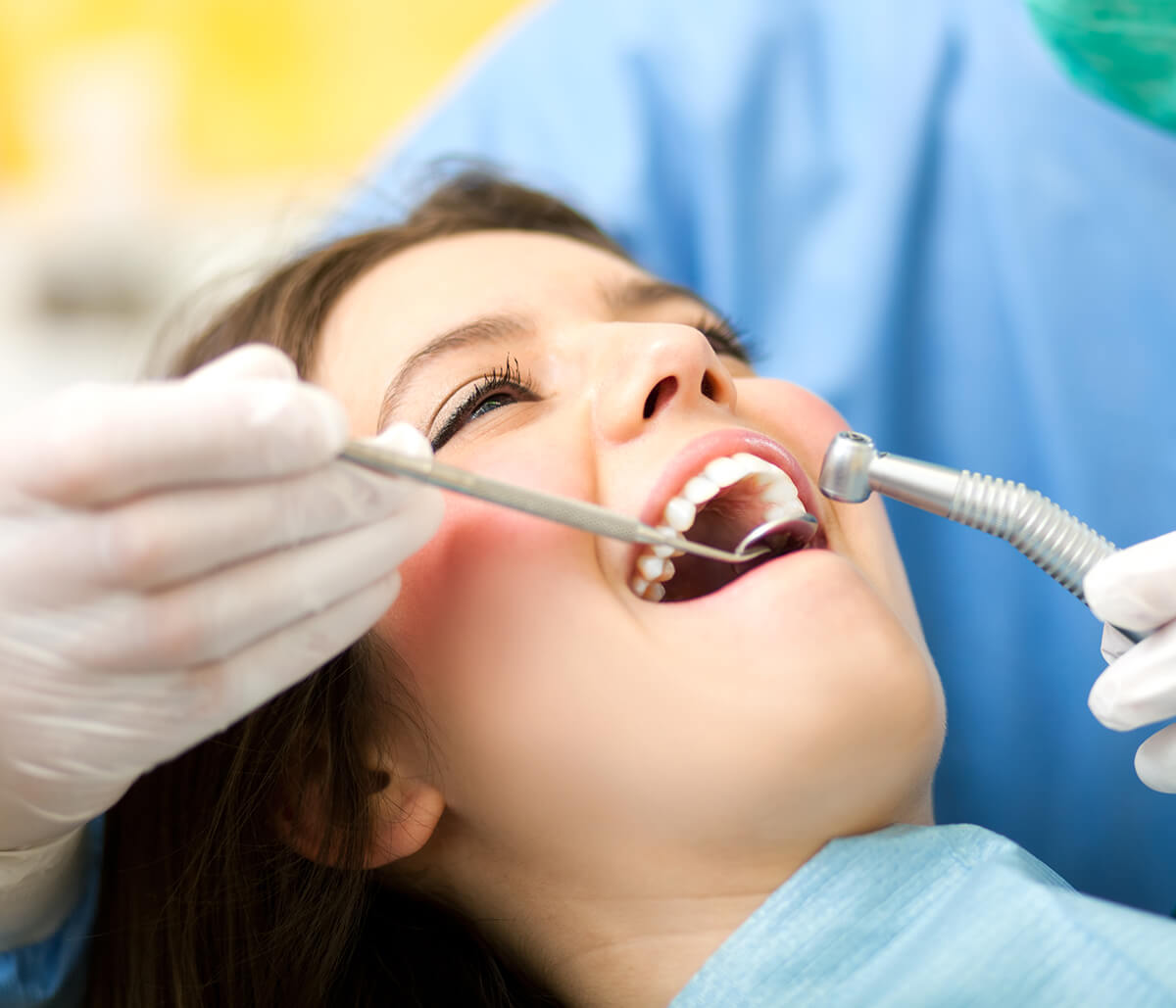 LANAP Procedure at Dental Health & Aesthetics Center in Aliso Viejo CA Area
