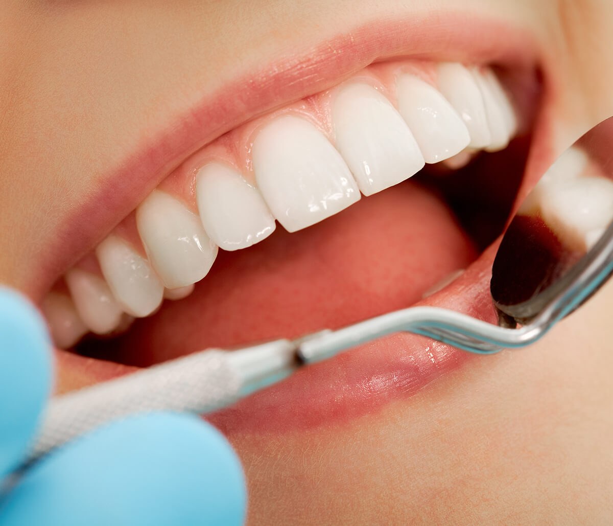 How Cosmetic Dentistry Can Change Your Life In Laguna Niguel CA Area