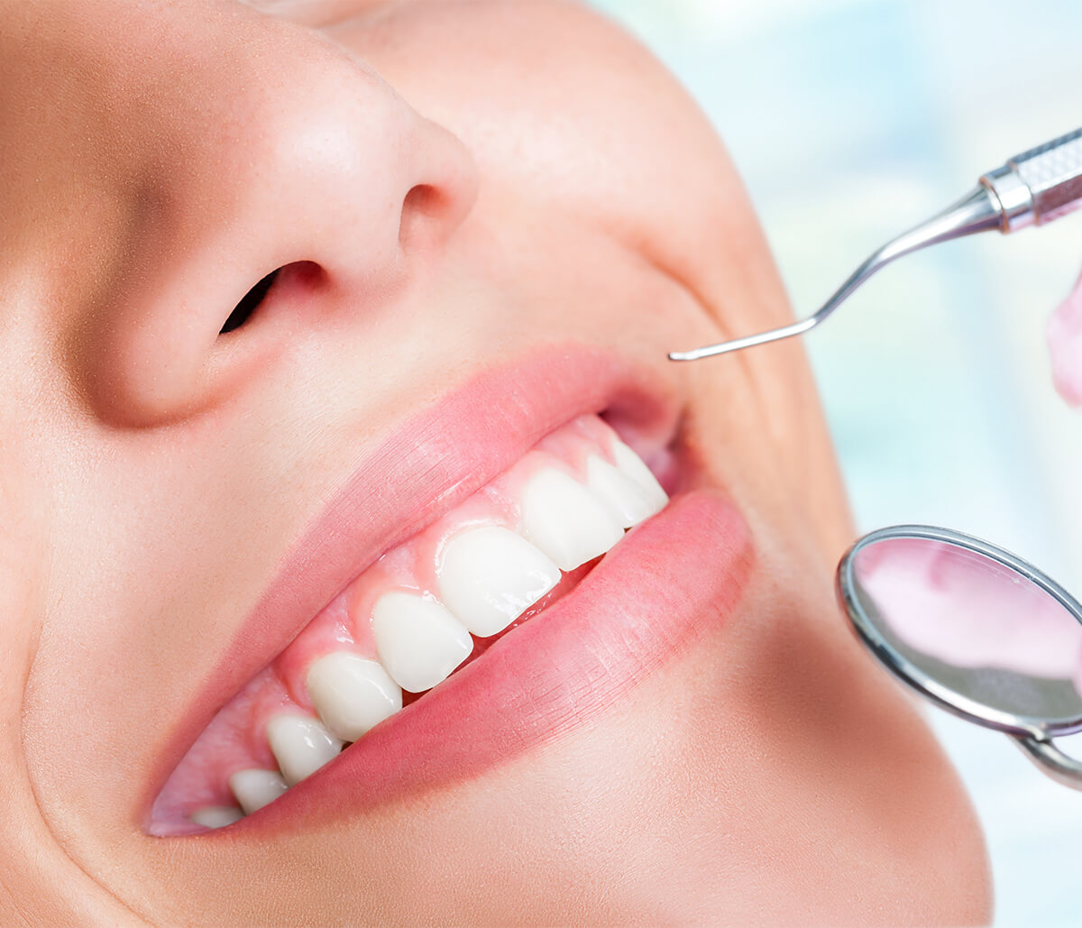Teeth Whitening Benefits in Aliso Viejo CA Area